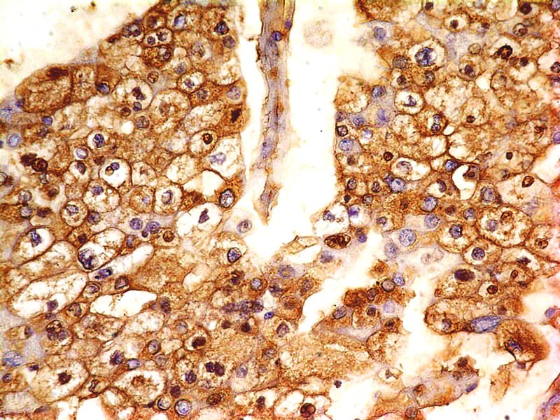 VTCN1 / B7-H4 Antibody