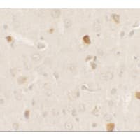 AKT1S1 / PRAS40 Antibody