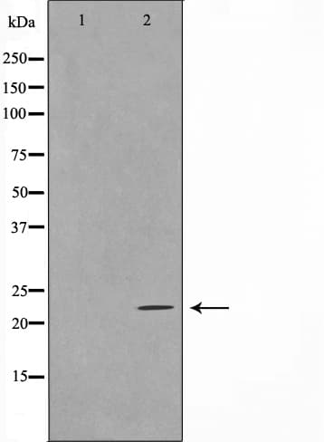 TNFSF13 / APRIL Antibody