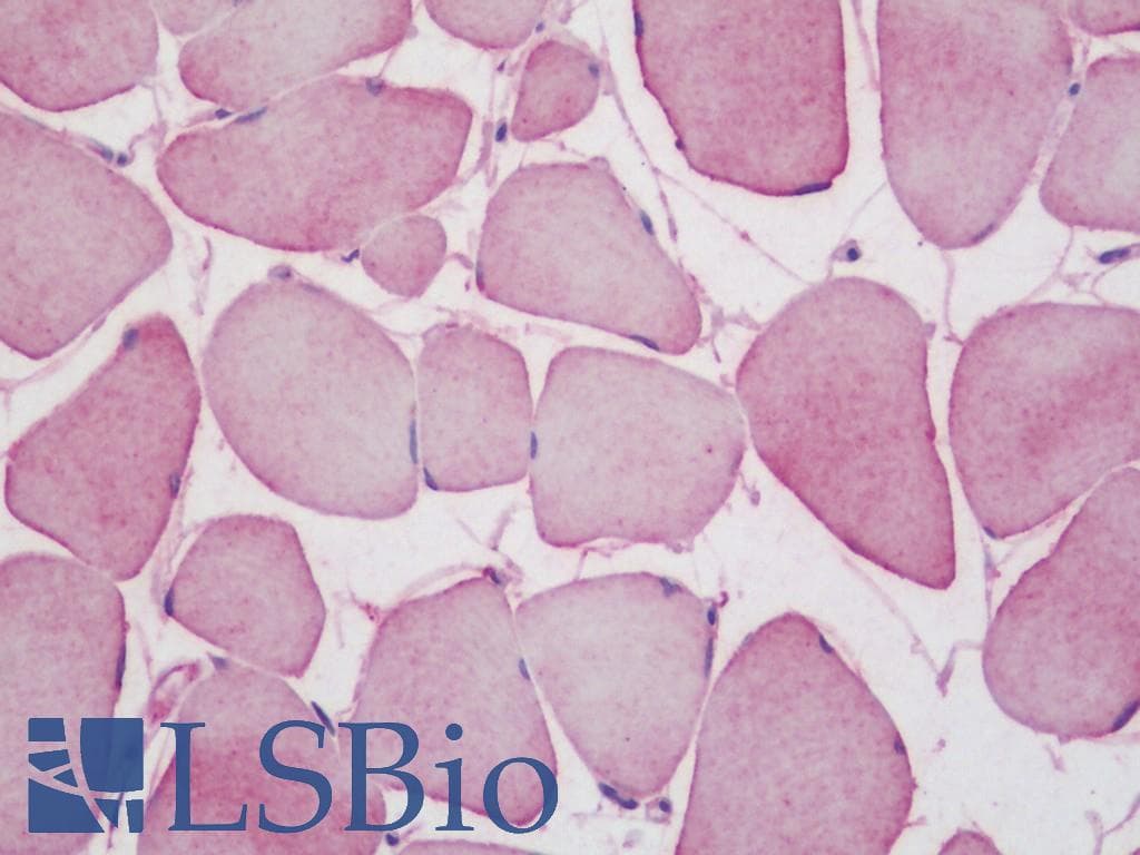 IHC-plus™ PFKM / PFK-1 Antibody (aa320-369)
