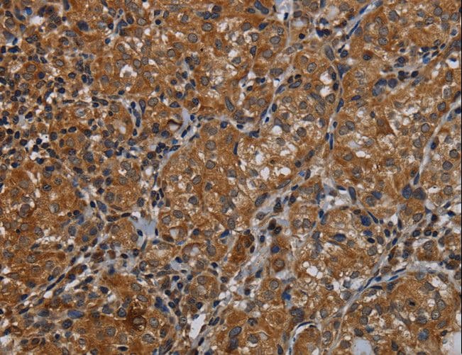 IVL / Involucrin Antibody
