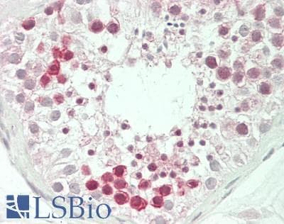 IHC-plus™ MED1 / TRAP220 Antibody (Internal)