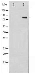 ITGB3 / Integrin Beta 3 / CD61 Antibody