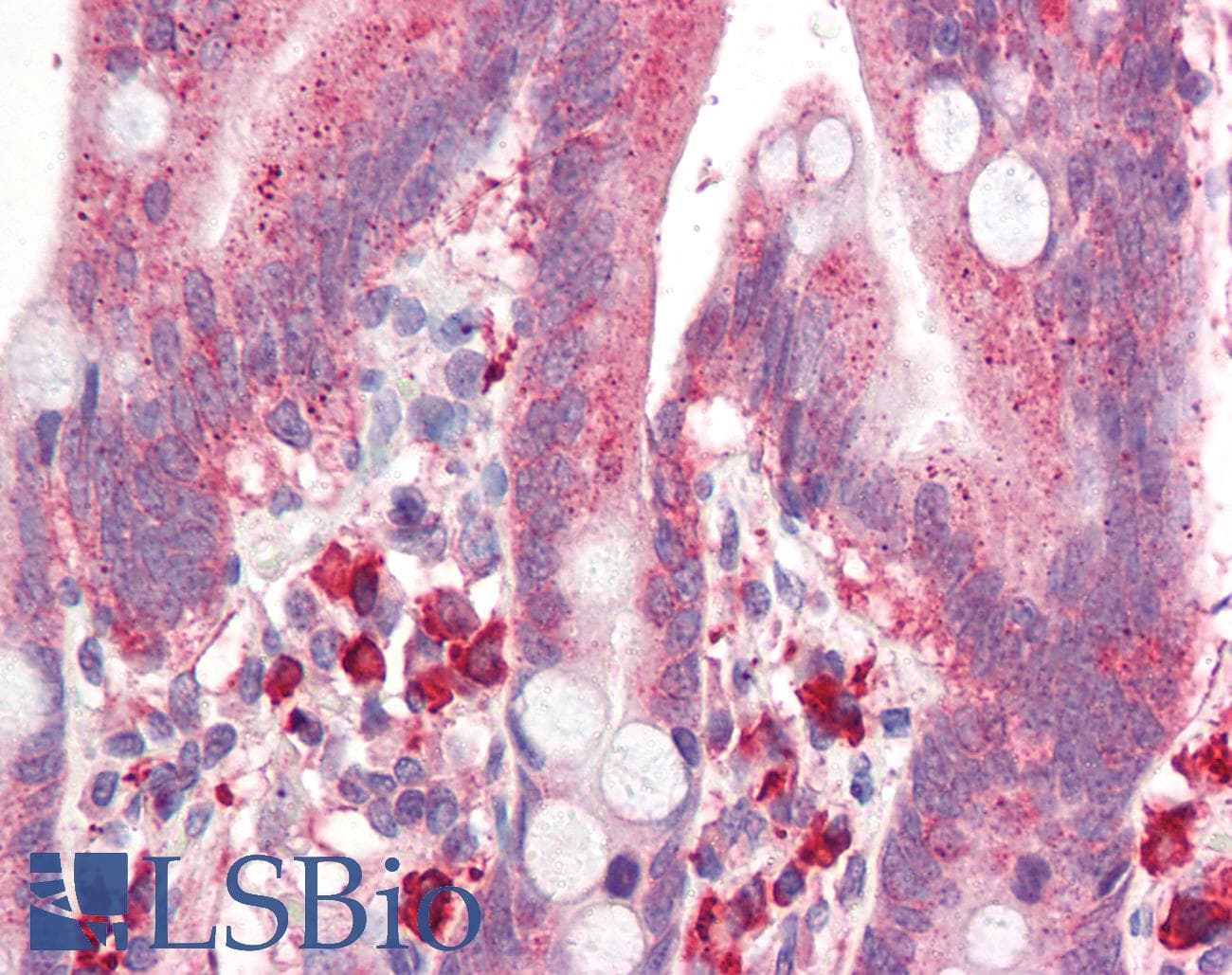 IHC-plus™ ACOT11 / THEA Antibody (aa19-250, clone J4B2)