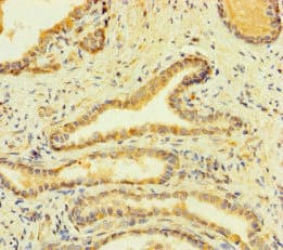 Polyclonal Rabbit anti-Human FcERI / Fc Epsilon RI Antibody (IHC, IF, WB)