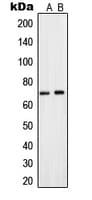 IHC-plus™ SLC28A2 Antibody (Internal)
