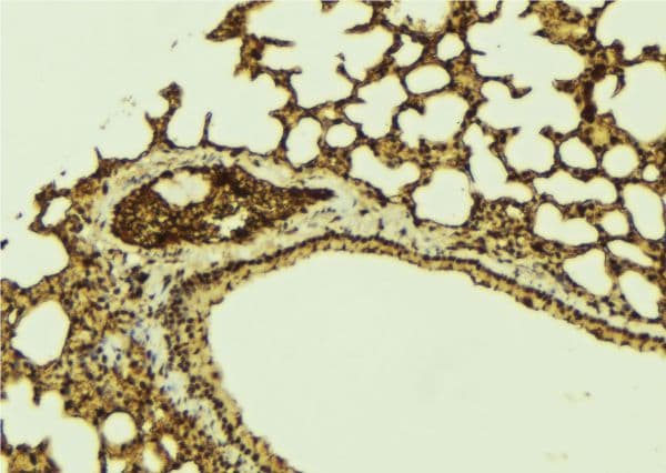 C14orf166 Antibody