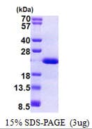 Human DHH / Desert Hedgehog Protein (Recombinant His)