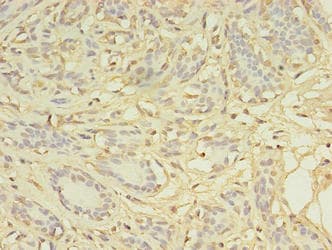 AGBL2 / CCP2 Antibody