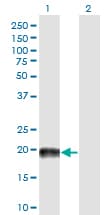 MAP4 Antibody (clone 7C9)
