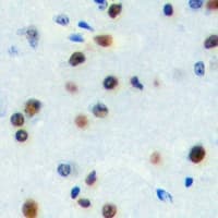 ZNF785 Antibody (Internal)
