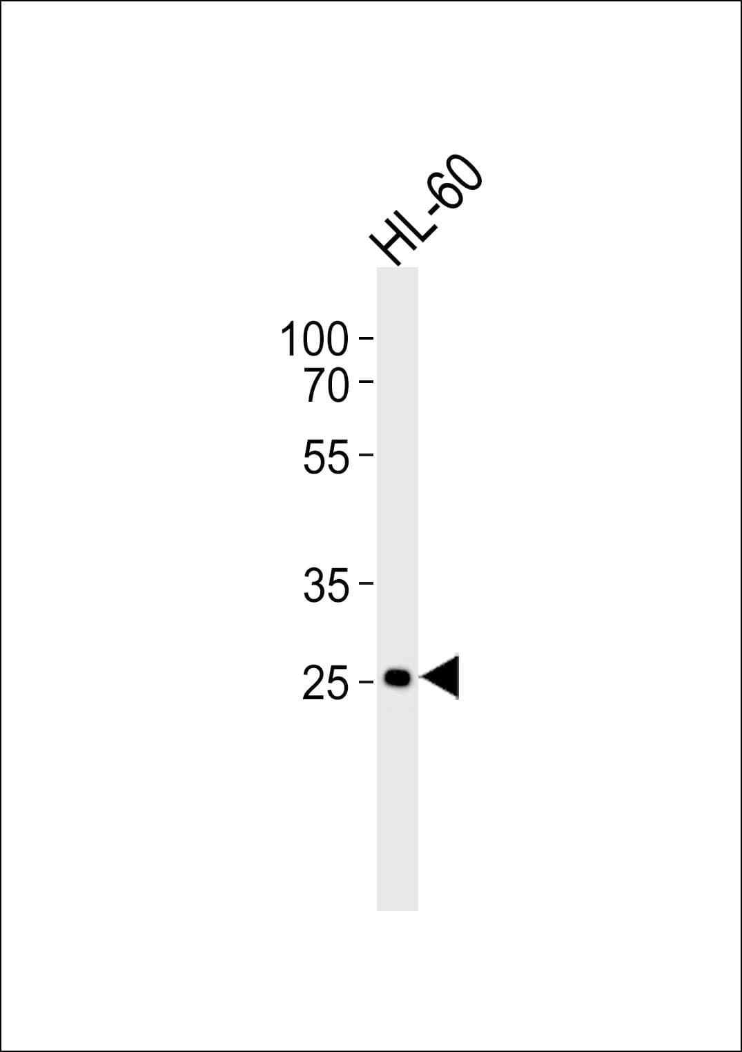 IHC-plus™ FCGR3B / CD16B Antibody (aa12-47)