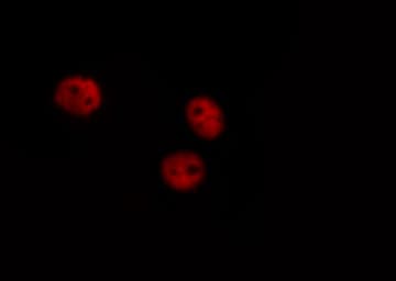 Polyclonal Rabbit anti-Human GATA4 Antibody (phospho-Ser262, IHC, IF, WB)