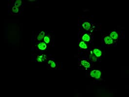 Monoclonal Mouse anti-Human SATB1 Antibody (clone OTI11E8, IHC, IF, WB)