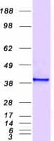 Human ANXA2 / Annexin A2 Protein (Recombinant Myc-DDK (Flag))