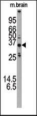 IHC-plus™ Polyclonal Rabbit anti-Human APG5 / ATG5 Antibody (aa1-30, IHC, IF, WB)