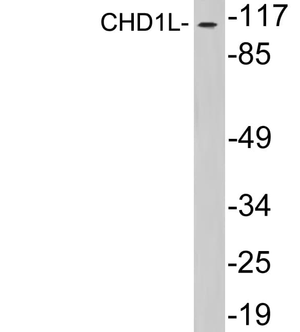 CHD1L Antibody (aa545-594)
