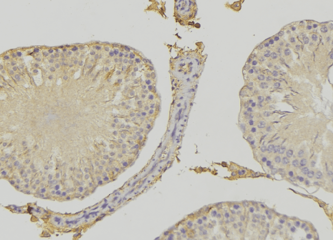 Polyclonal Rabbit anti-Human RHOBTB3 Antibody (IHC, WB)