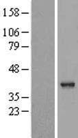 VASH2 Protein (Over-Expression Lysate Myc-DDK (Flag))