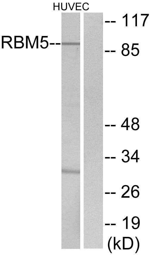 RBM5 / G15 Antibody (aa226-275)