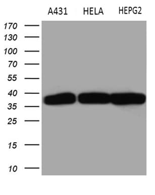TALDO1 / Transaldolase 1 Antibody (clone OTI2E4)