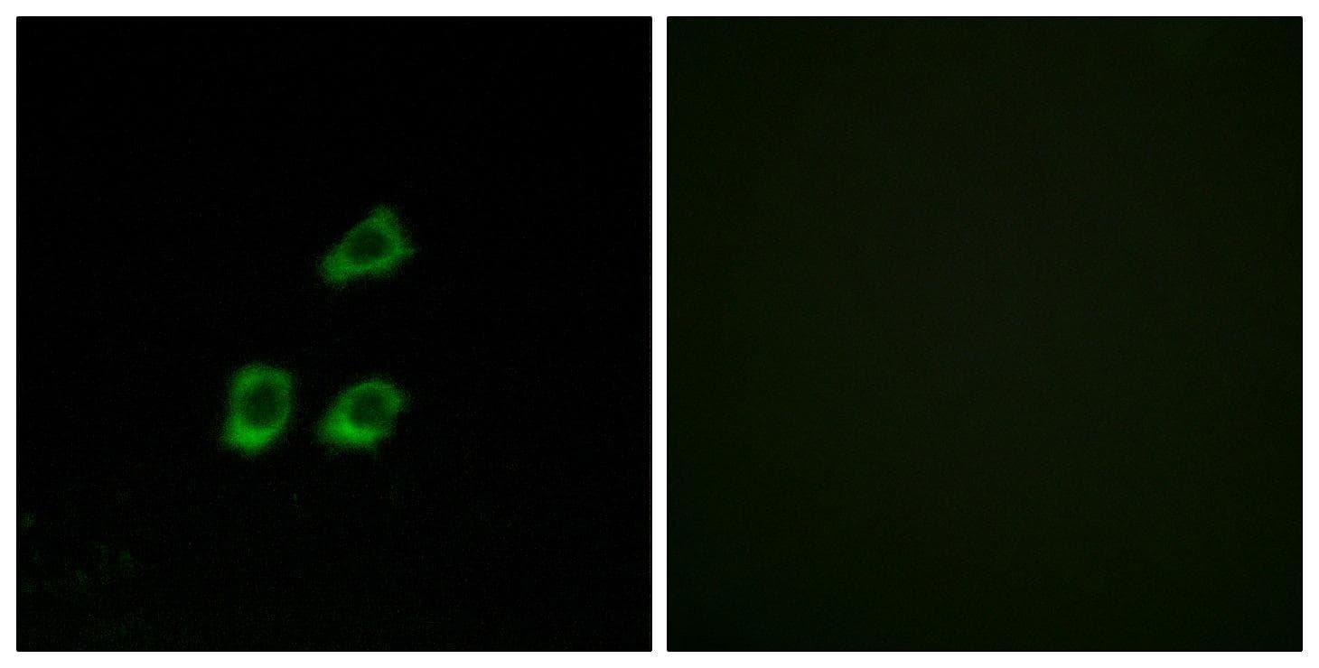 CLCN4 / CLC-4 Antibody