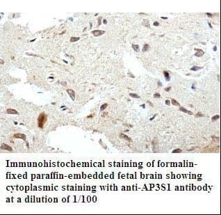 AP3S1 Antibody (aa2-193)