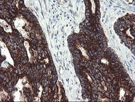Monoclonal Mouse anti-Human GBAS Antibody (clone 1B8, Carrier-free, IHC, IF, WB)