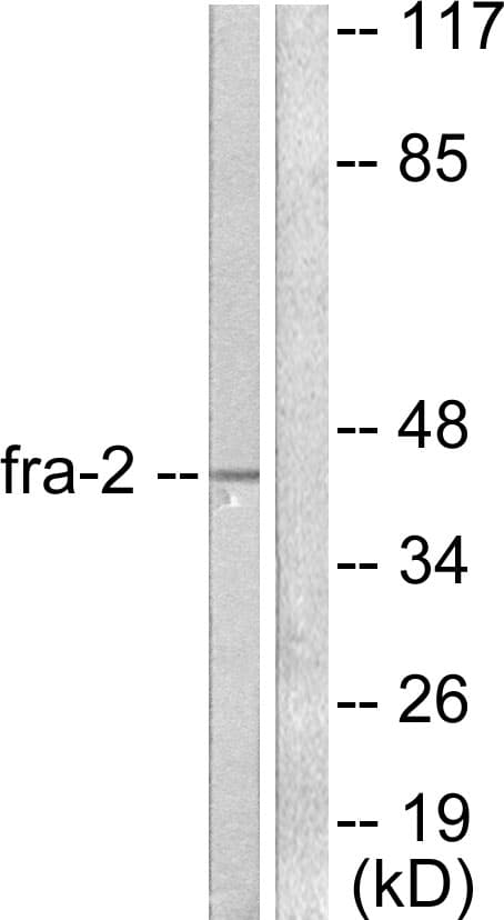 FOSL2 / FRA-2 Antibody (aa271-320)