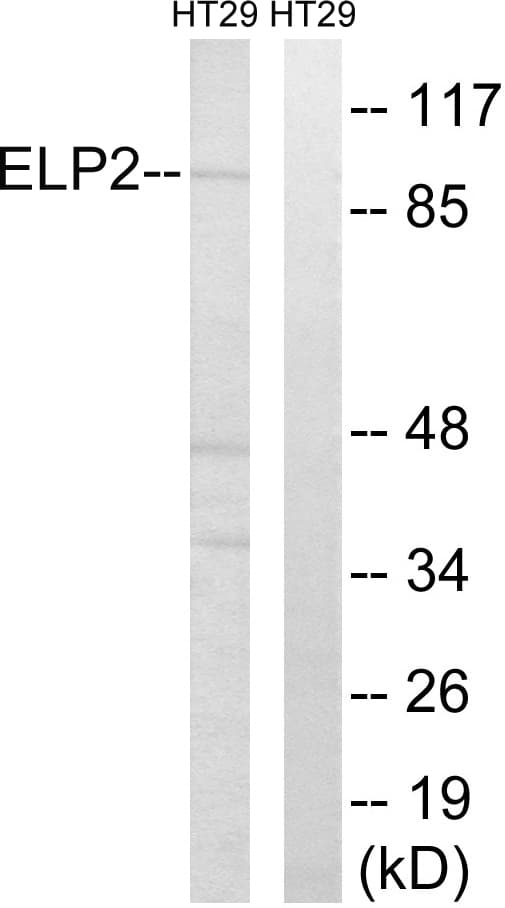 ELP2 / STATIP1 Antibody (aa771-820)