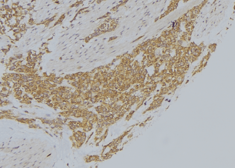 Polyclonal Rabbit anti-Human MICAL1 / MICAL Antibody (IHC, IF, WB)
