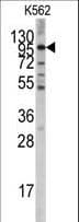 GPR49 / LGR5 Antibody (aa443-473)