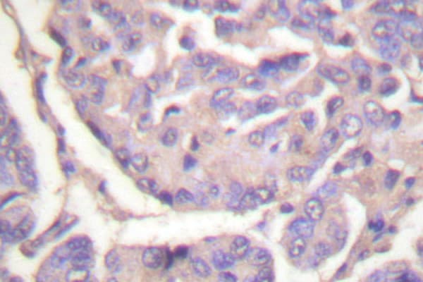 Polyclonal Rabbit anti-Human c-CBL Antibody (Gly694, IHC, IF, WB)