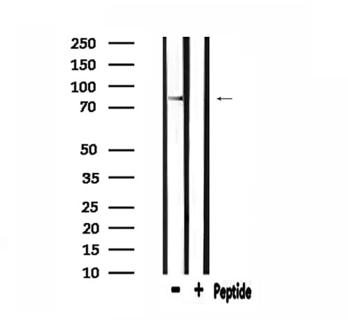 CDH18 / Ey-Cadherin Antibody