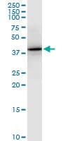 Monoclonal Mouse anti-Human PTX3 / Pentraxin 3 Antibody (clone 5B7, WB)
