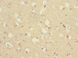 CHRNA9 Antibody