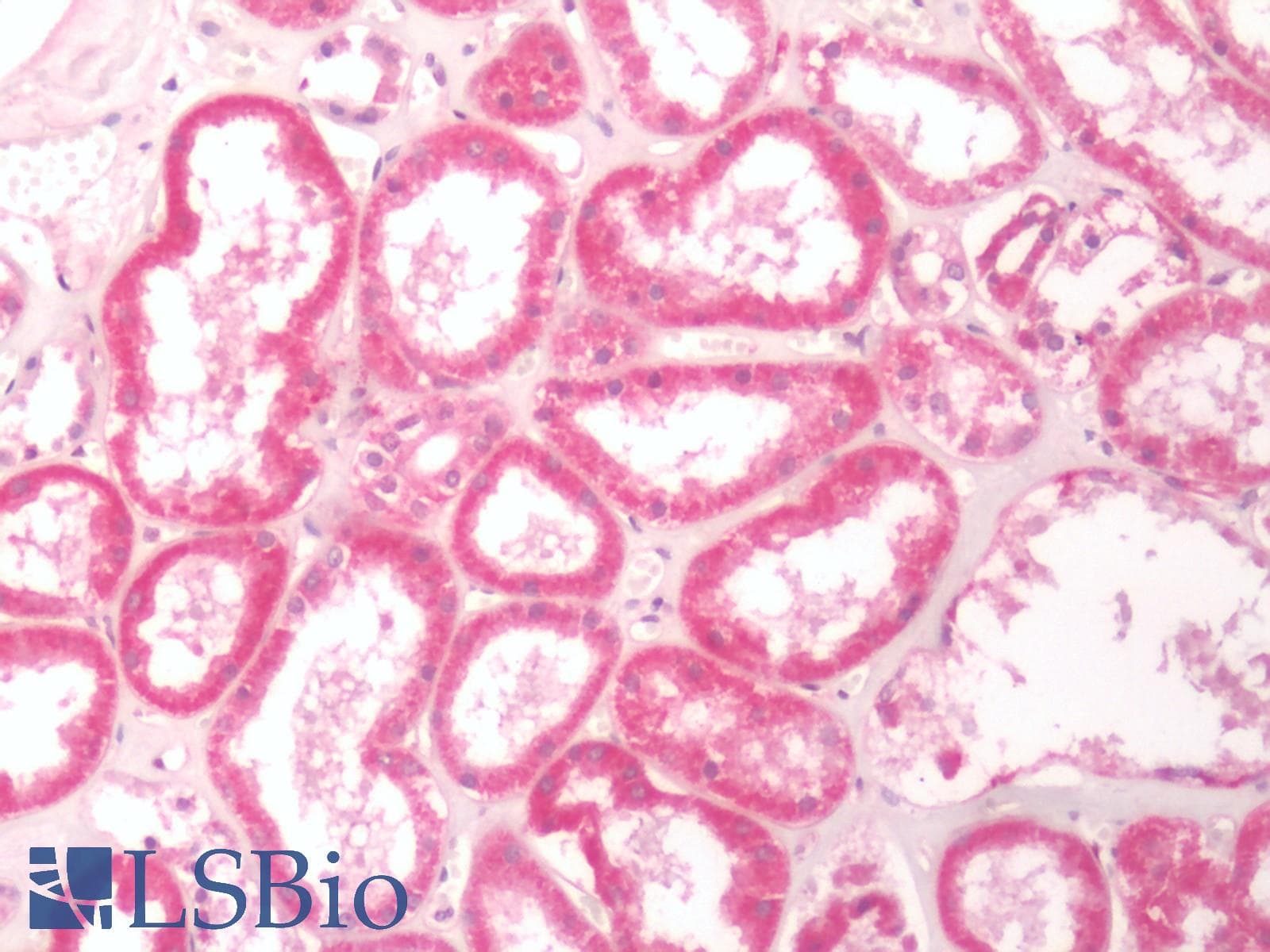 IHC-plus™ TRPA1 Antibody (Internal)