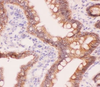 Alpha Catenin Antibody (aa143-292)