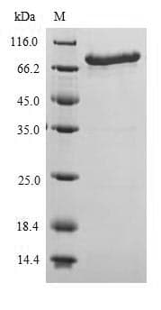 E. coli Polymyxin resistance protein MCR-1 (Recombinant 6His-SUMO, N-terminus)
