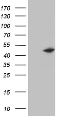KRT14 / CK14 / Cytokeratin 14 Antibody (aa148-472, clone OTI3C7)