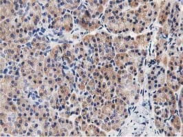 Monoclonal Mouse anti-Human GPR49 / LGR5 Antibody (clone OTI2H7, aa250-550, IHC, IF, WB)