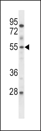 Polyclonal Rabbit anti-Human ETV6 / TEL Antibody (aa173-202, WB)