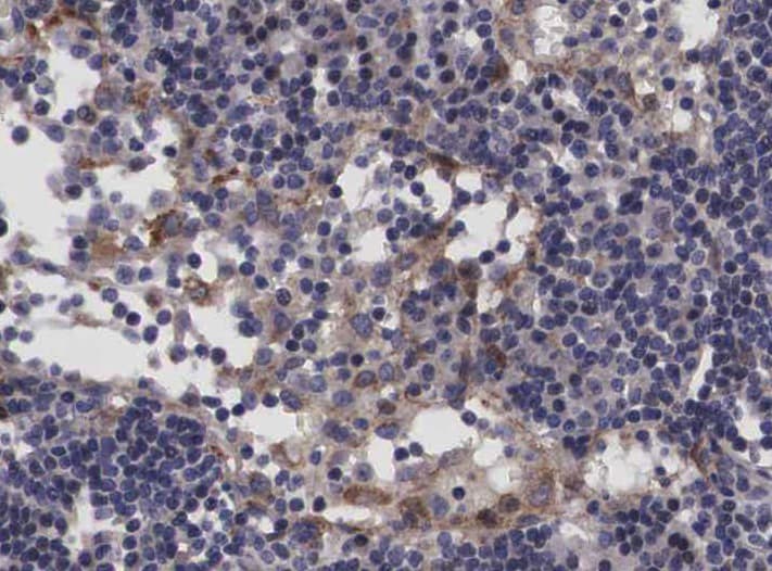 Polyclonal Rabbit anti-Human TP53I11 / PIG11 Antibody (IHC, IF, WB)