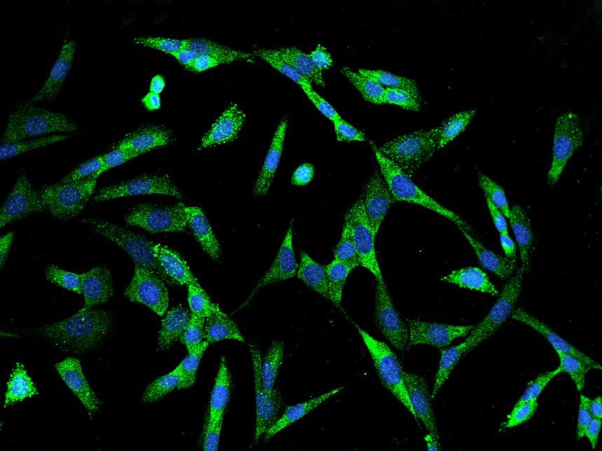 CRABP2 Antibody (Preservative Free)