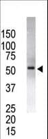 USP14 Antibody (aa1-30)
