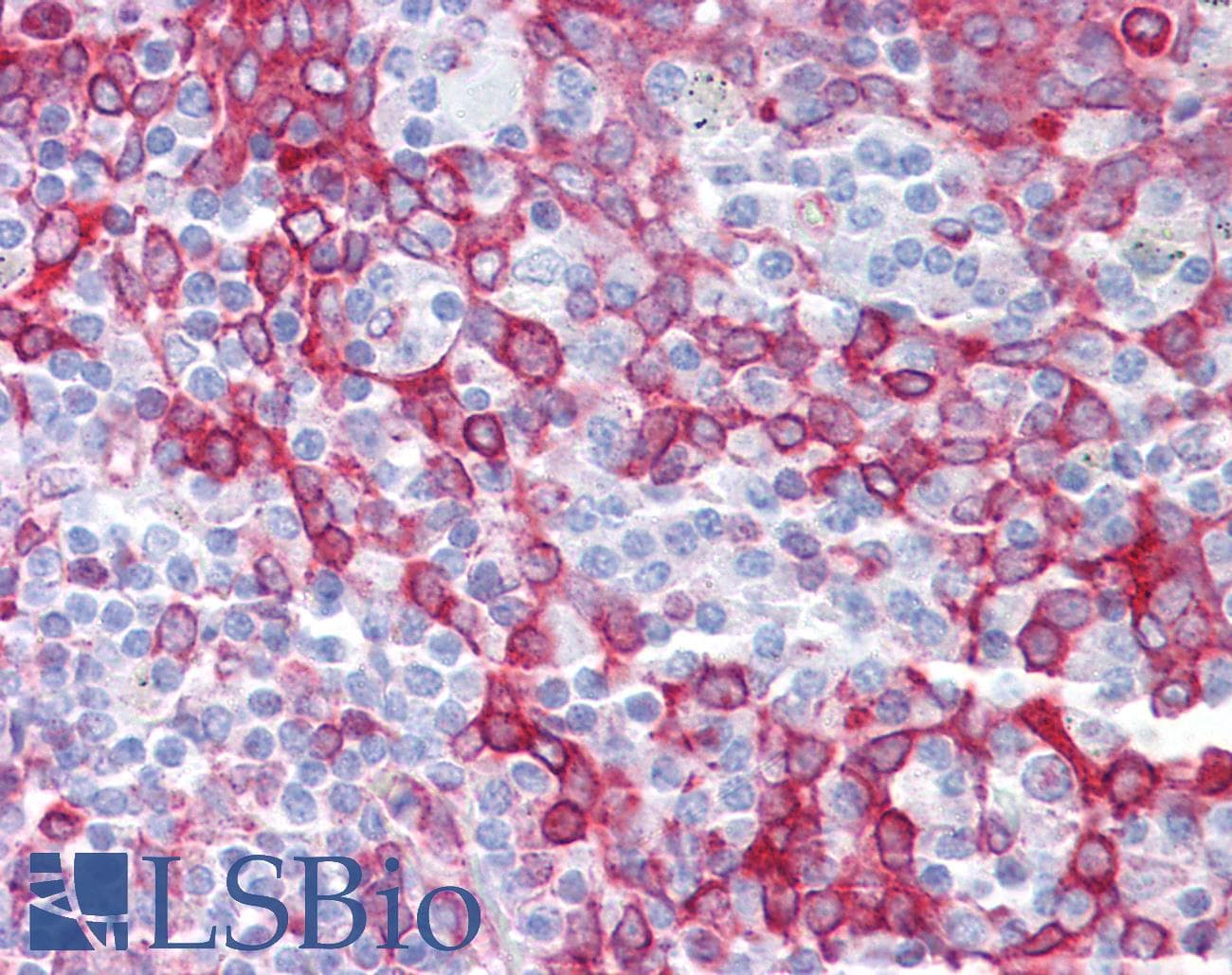 IHC-plus™ OGFOD1 Antibody