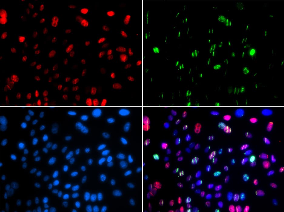 TP53 / p53 Antibody (phospho-Ser15)