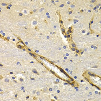 KLKB1 / Plasma Kallikrein Antibody