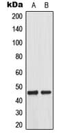 MAP2K1 / MKK1 / MEK1 Antibody (phospho-Thr292)