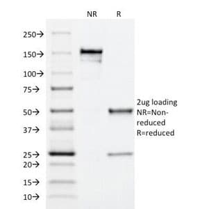 Monoclonal Mouse anti-Human ITGAM / CD11b Antibody (clone ITGAM/271, Azide-free,BSA-free, IF)